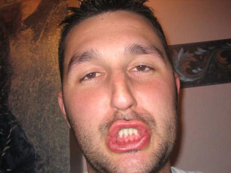 jimmy